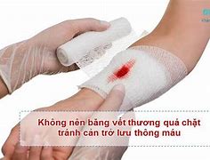 Nên Băng Vết Thương Hay Để Hở